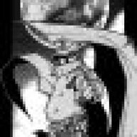 DemonDruss
