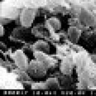 Yersinia pestis